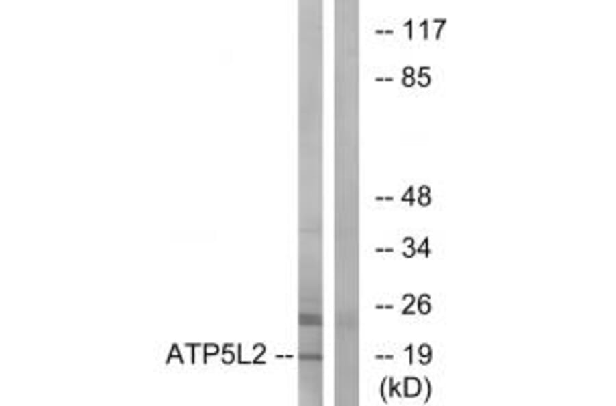 Western blot - ATP5L2 Antibody from Signalway Antibody (34454) - Antibodies.com