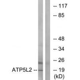 Western blot - ATP5L2 Antibody from Signalway Antibody (34454) - Antibodies.com