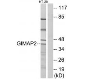 Western blot - GIMAP2 Antibody from Signalway Antibody (34717) - Antibodies.com