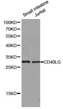 Western blot analysis of small intestine cell and Jurkat cell lysate using CD40LG antibody.