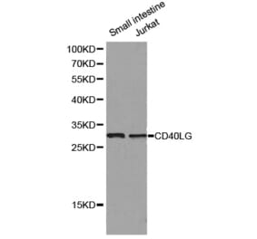 Western blot - CD40LG antibody from Signalway Antibody (38129) - Antibodies.com