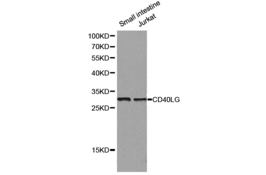 Western blot - CD40LG antibody from Signalway Antibody (38129) - Antibodies.com