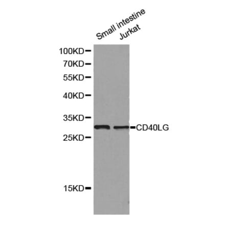 Western blot - CD40LG antibody from Signalway Antibody (38129) - Antibodies.com