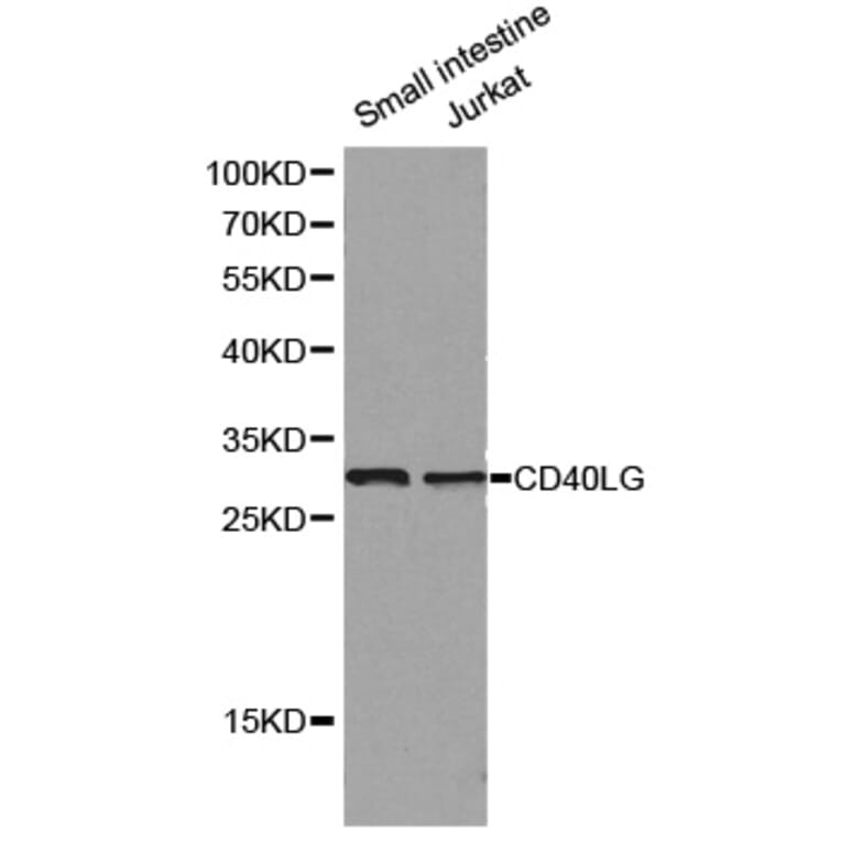 Western blot - CD40LG antibody from Signalway Antibody (38129) - Antibodies.com