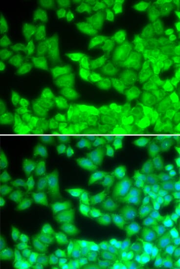 Immunofluorescence analysis of U20S cell using CD40LG antibody. Blue: DAPI for nuclear staining.