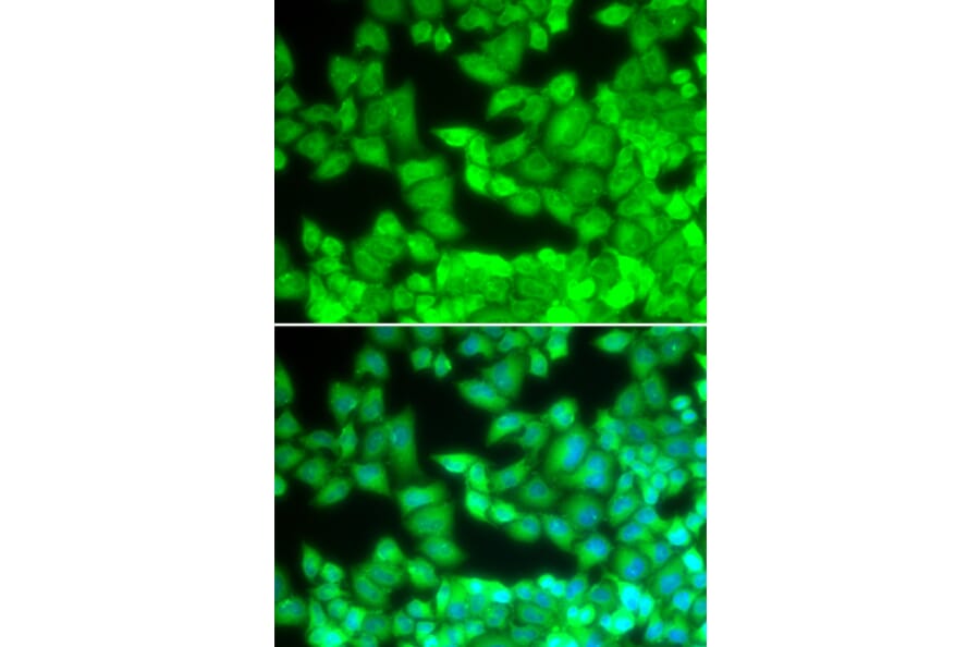 Immunofluorescence - CD40LG antibody from Signalway Antibody (38129) - Antibodies.com