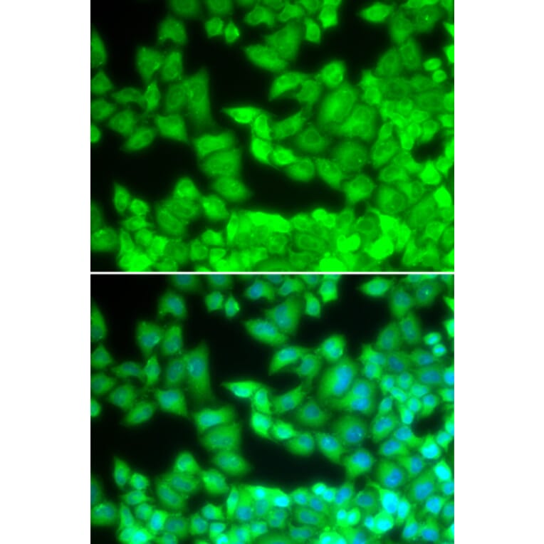 Immunofluorescence - CD40LG antibody from Signalway Antibody (38129) - Antibodies.com