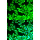 Immunofluorescence - CD40LG antibody from Signalway Antibody (38129) - Antibodies.com