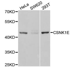 Western blot - CSNK1E antibody from Signalway Antibody (38302) - Antibodies.com