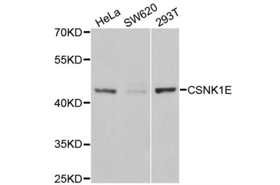 Western blot - CSNK1E antibody from Signalway Antibody (38302) - Antibodies.com