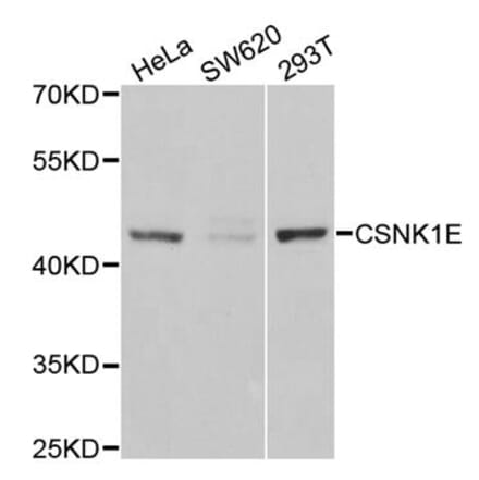 Western blot - CSNK1E antibody from Signalway Antibody (38302) - Antibodies.com