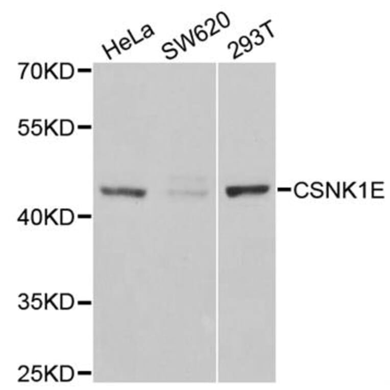 Western blot - CSNK1E antibody from Signalway Antibody (38302) - Antibodies.com
