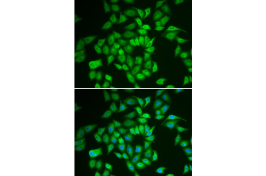 Immunofluorescence - CSNK1E antibody from Signalway Antibody (38302) - Antibodies.com