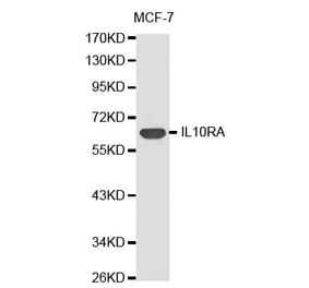 Western blot - IL10RA antibody from Signalway Antibody (38306) - Antibodies.com