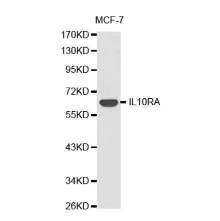 Western blot - IL10RA antibody from Signalway Antibody (38306) - Antibodies.com