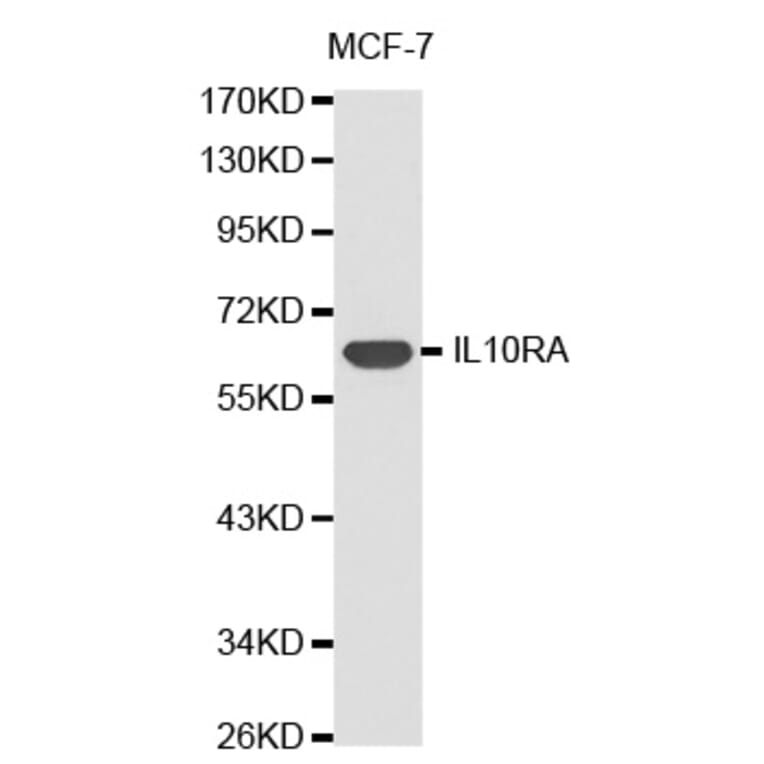 Western blot - IL10RA antibody from Signalway Antibody (38306) - Antibodies.com