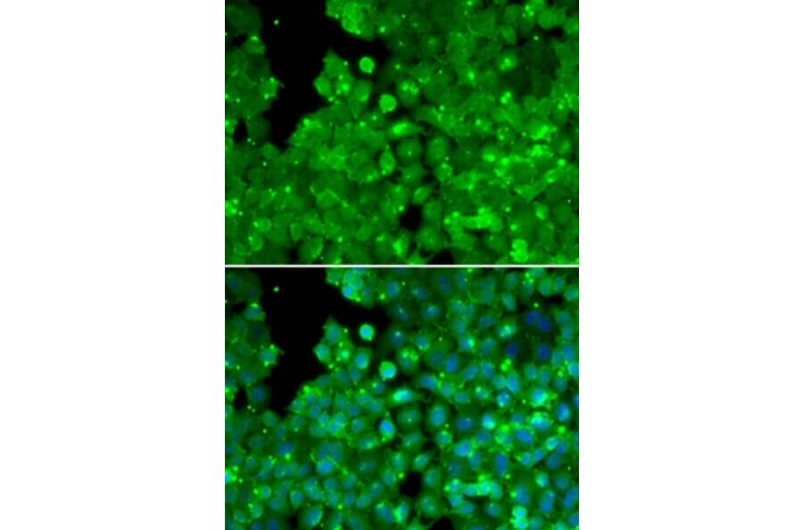 Immunofluorescence - IL10RA antibody from Signalway Antibody (38306) - Antibodies.com
