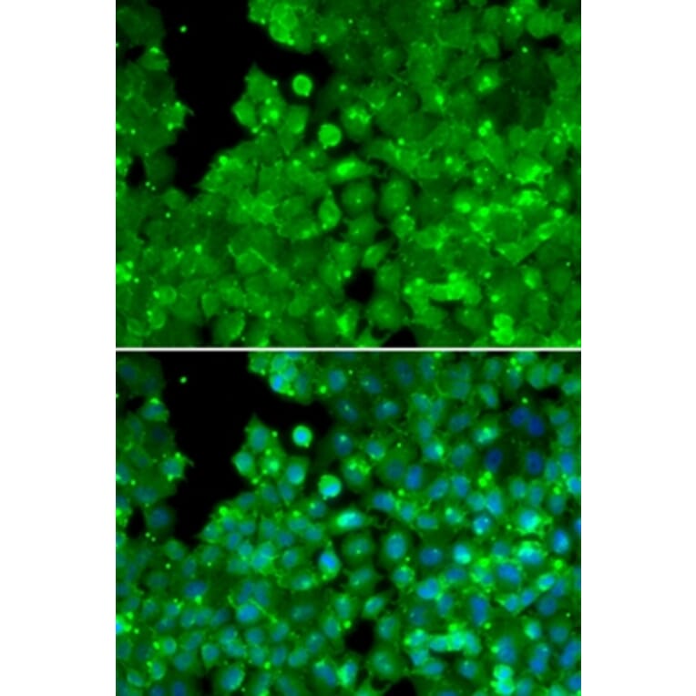 Immunofluorescence - IL10RA antibody from Signalway Antibody (38306) - Antibodies.com