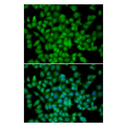 Immunofluorescence - CDKN2C antibody from Signalway Antibody (38340) - Antibodies.com