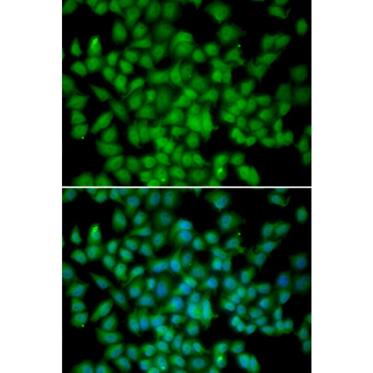 Immunofluorescence - CDKN2C antibody from Signalway Antibody (38340) - Antibodies.com