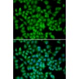 Immunofluorescence - CDKN2C antibody from Signalway Antibody (38340) - Antibodies.com