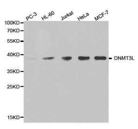 Western blot - DNMT3L antibody from Signalway Antibody (38399) - Antibodies.com