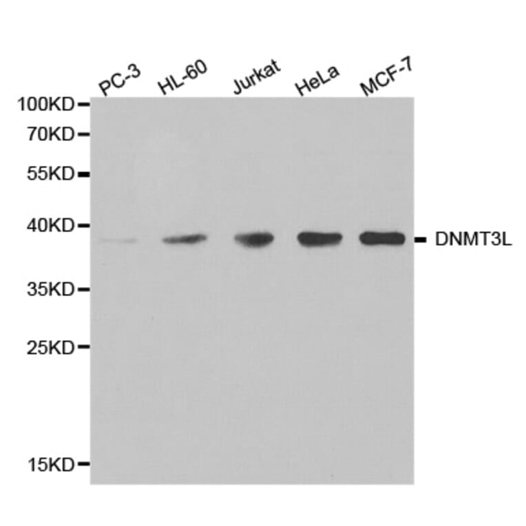 Western blot - DNMT3L antibody from Signalway Antibody (38399) - Antibodies.com