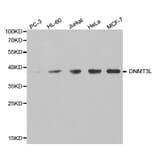 Western blot - DNMT3L antibody from Signalway Antibody (38399) - Antibodies.com