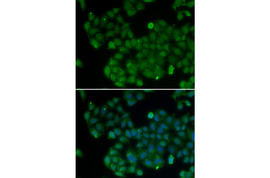 Immunofluorescence - DNMT3L antibody from Signalway Antibody (38399) - Antibodies.com