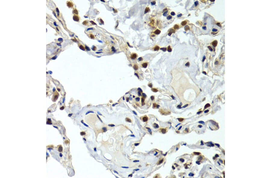 Immunohistochemistry - GTF2F1 antibody from Signalway Antibody (38407) - Antibodies.com