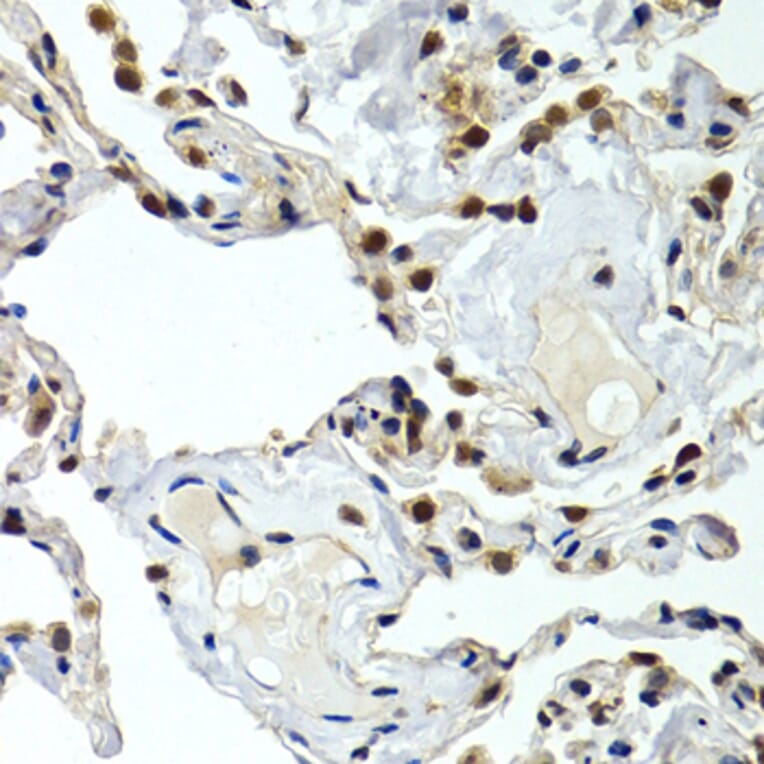 Immunohistochemistry - GTF2F1 antibody from Signalway Antibody (38407) - Antibodies.com