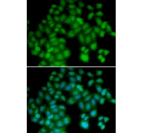 Immunofluorescence - TMSB4X antibody from Signalway Antibody (38656) - Antibodies.com