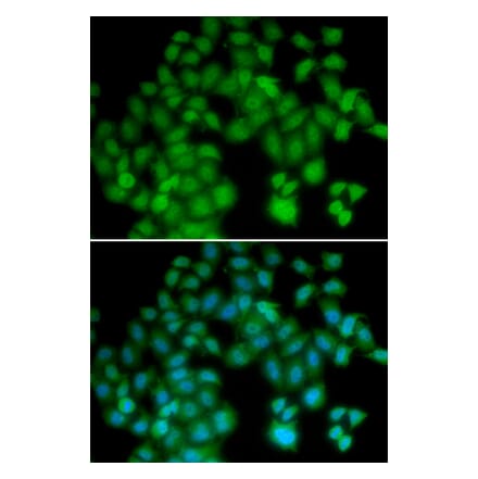 Immunofluorescence - TMSB4X antibody from Signalway Antibody (38656) - Antibodies.com