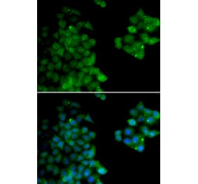 Immunofluorescence - PSMB10 antibody from Signalway Antibody (38658) - Antibodies.com