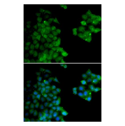 Immunofluorescence - PSMB10 antibody from Signalway Antibody (38658) - Antibodies.com