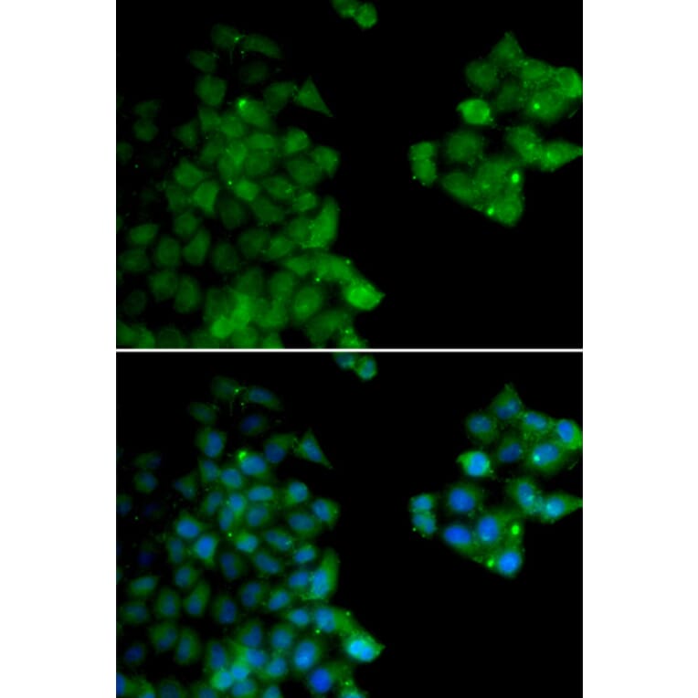 Immunofluorescence - PSMB10 antibody from Signalway Antibody (38658) - Antibodies.com