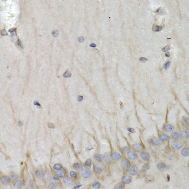 Immunohistochemistry - PSMB10 antibody from Signalway Antibody (38658) - Antibodies.com