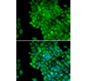Immunofluorescence - MAGEA1 antibody from Signalway Antibody (38661) - Antibodies.com