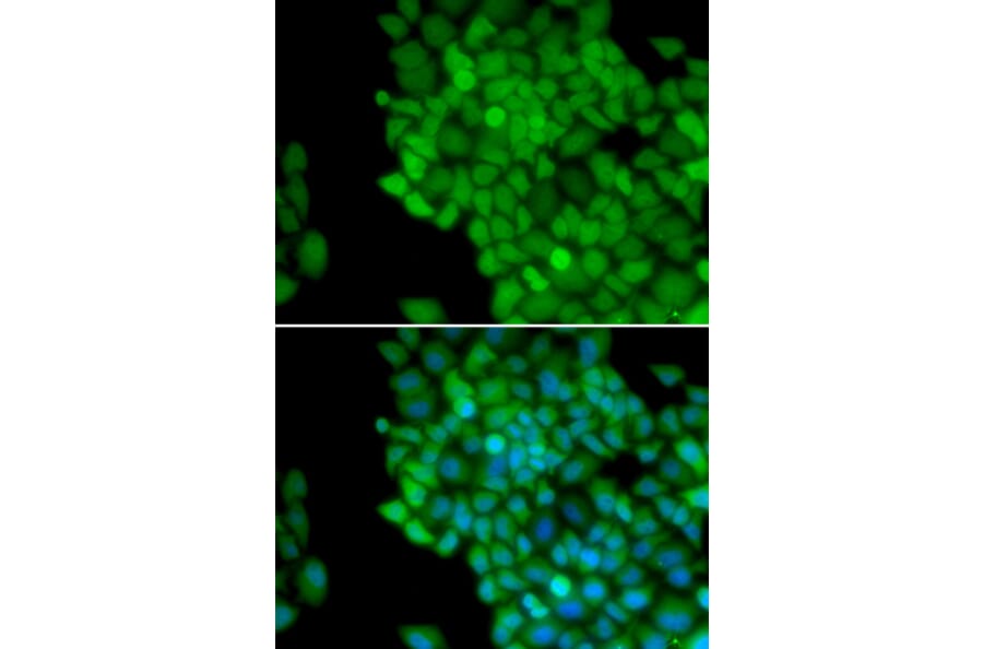 Immunofluorescence - MAGEA1 antibody from Signalway Antibody (38661) - Antibodies.com