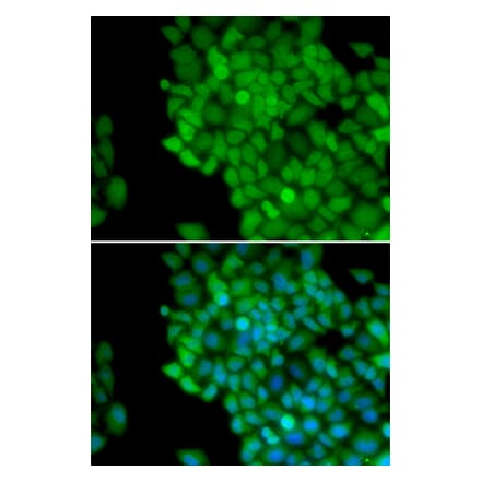 Immunofluorescence - MAGEA1 antibody from Signalway Antibody (38661) - Antibodies.com