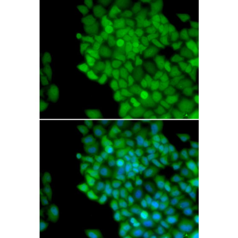 Immunofluorescence - MAGEA1 antibody from Signalway Antibody (38661) - Antibodies.com