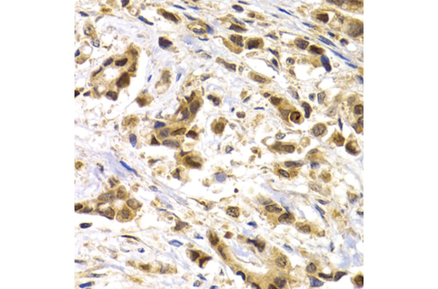 Immunohistochemistry - MAGEA1 antibody from Signalway Antibody (38661) - Antibodies.com