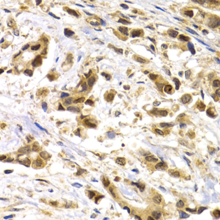 Immunohistochemistry - MAGEA1 antibody from Signalway Antibody (38661) - Antibodies.com