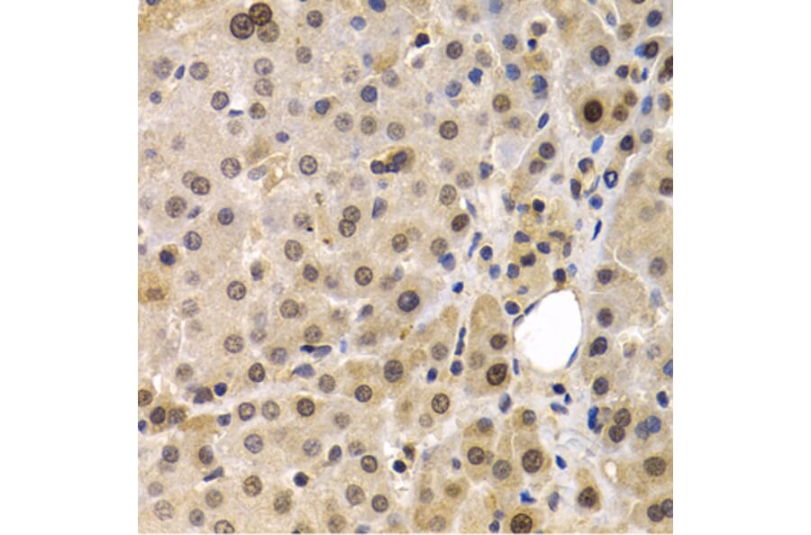 Immunohistochemistry - MAGEA1 antibody from Signalway Antibody (38661) - Antibodies.com