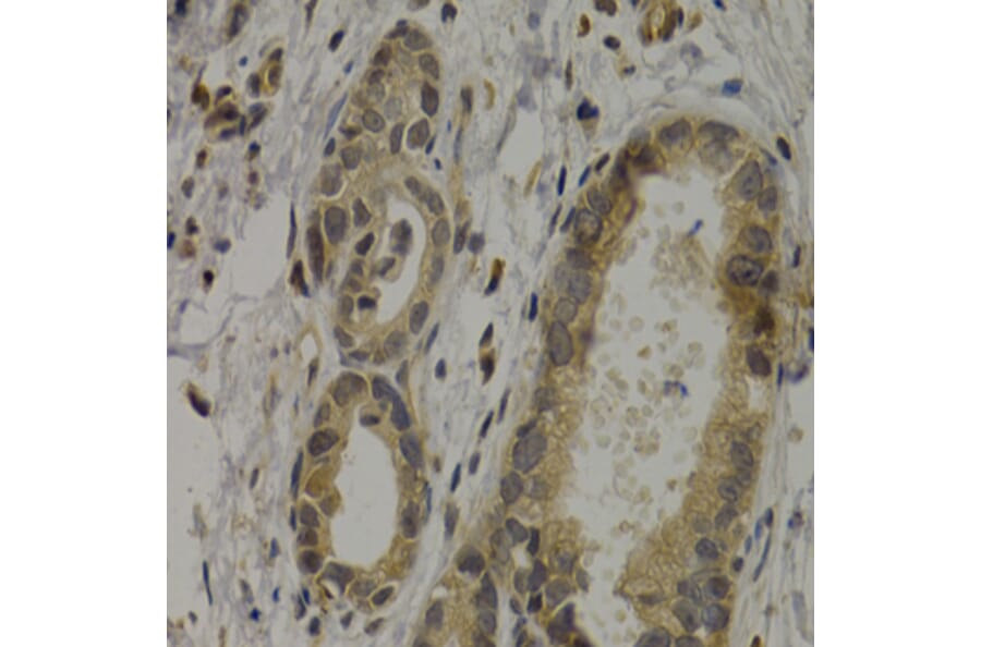 Immunohistochemistry - MAGEA1 antibody from Signalway Antibody (38661) - Antibodies.com