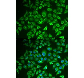 Immunofluorescence - EHHADH antibody from Signalway Antibody (38685) - Antibodies.com