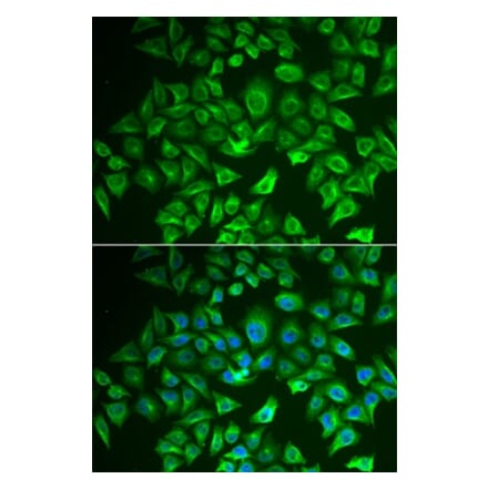 Immunofluorescence - EHHADH antibody from Signalway Antibody (38685) - Antibodies.com