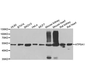 Western blot - ATP5A1 antibody from Signalway Antibody (38707) - Antibodies.com