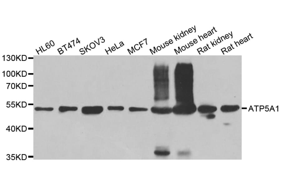 Western blot - ATP5A1 antibody from Signalway Antibody (38707) - Antibodies.com
