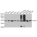 Western blot - ATP5A1 antibody from Signalway Antibody (38707) - Antibodies.com